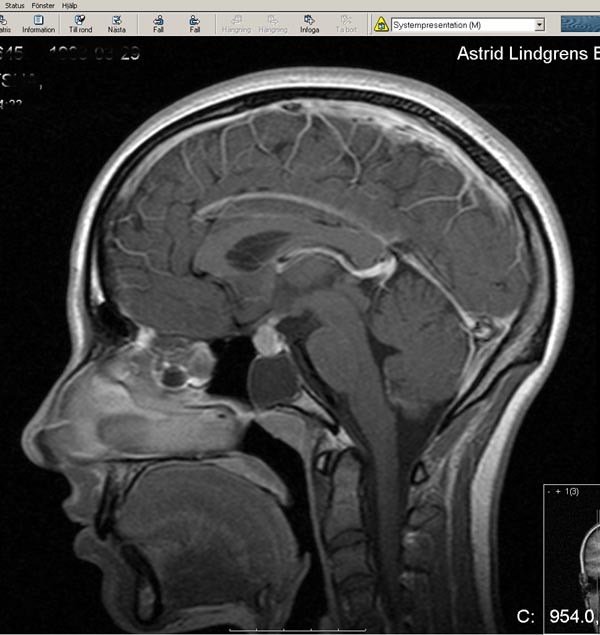 Photo Rework. MRI scan mri brain scan. Photo Rework. MRI scan