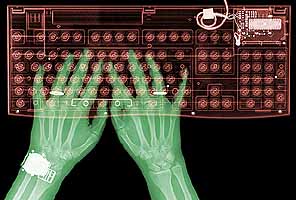 X-rayed hands and keyboard
